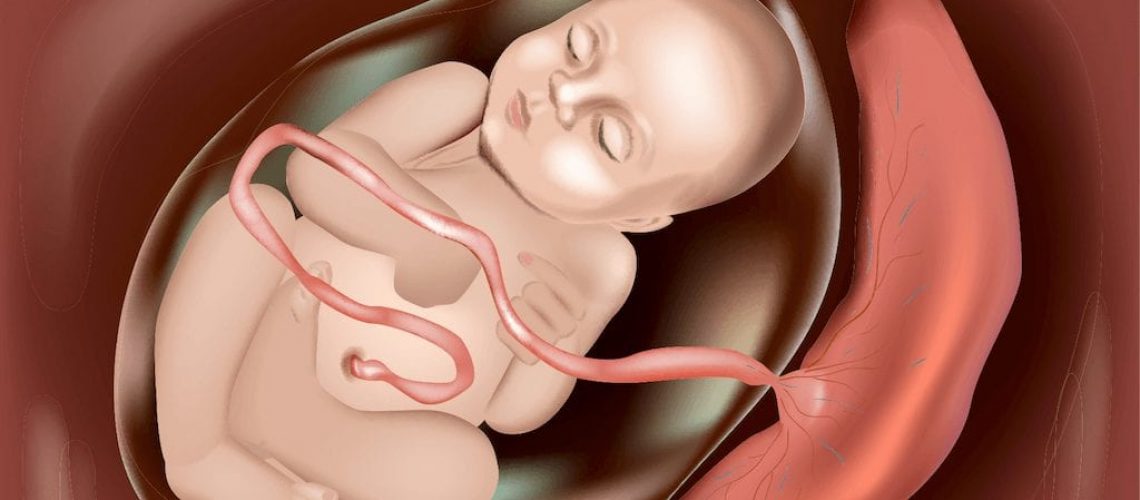 Microplasticos placenta humana